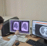Пензенцев приглашают на бесплатное флюорографическое обследование - SMI58.Ru